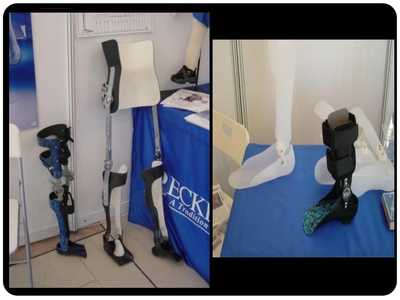 假肢與矯形器 功能、技術(shù)與應(yīng)用概述